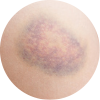 vit-c_3
